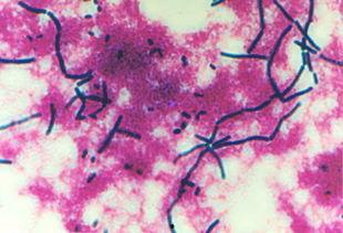 显微镜下的细菌视频